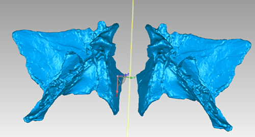 Mirrored bone scans for the final model