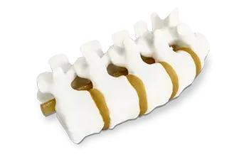 3D Systems로 3D 프린트된 척추 해부학 모델