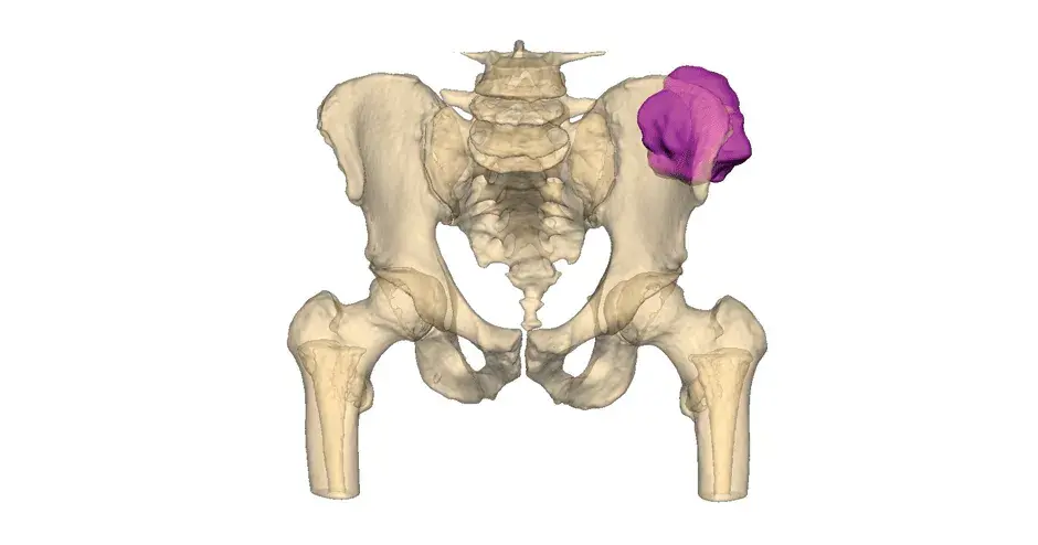 Web-Thumbnail-vsp-orthopaedics-pelvic-case-pre-op