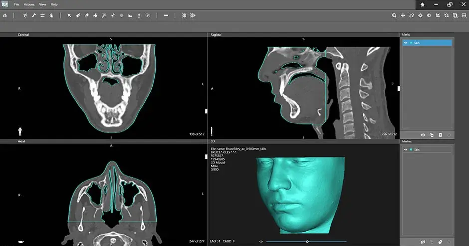D2P Bolus Screenshot