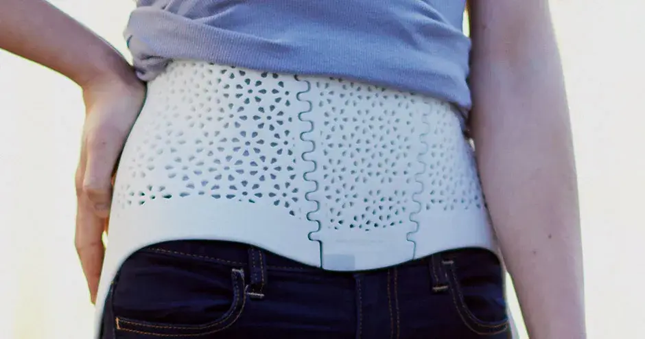 3D printed scoliosis back brace