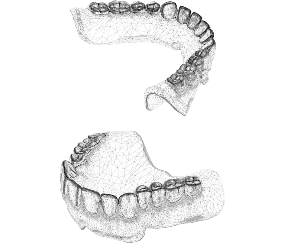 NextDent 프로덕션 CAD 파일