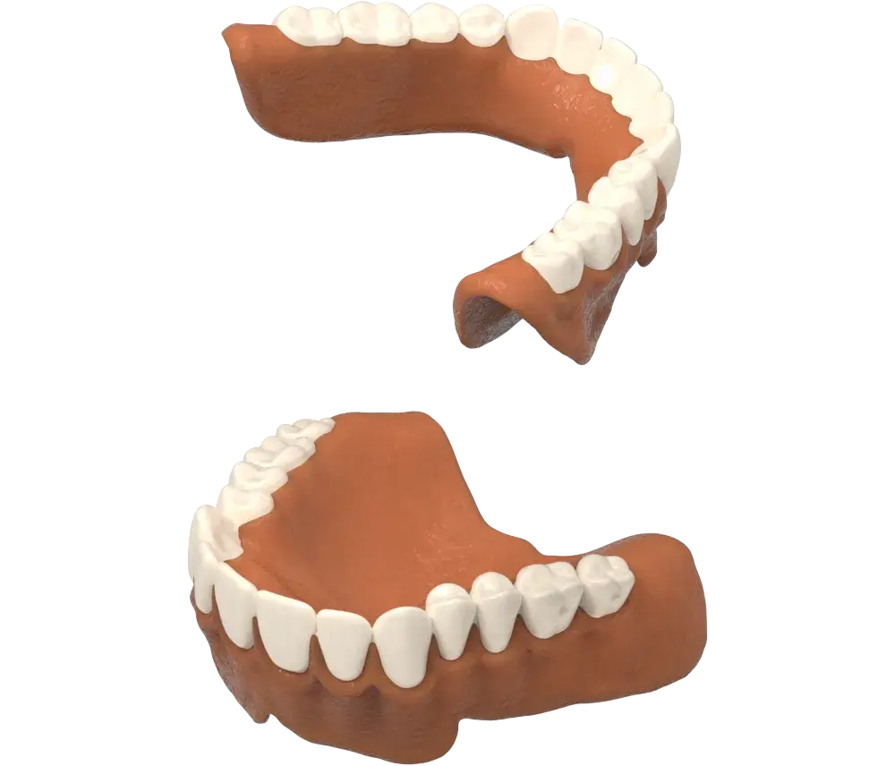 NextDent 생산 왁스가 제거되었습니다.