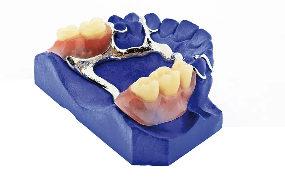 Vertex Cold Curing Acrylic